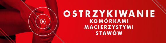 Leczenie bioder – osocze bogatopłytkowe jako skuteczna metoda regeneracji 1 Leczenie bioder – osocze bogatopłytkowe jako skuteczna metoda regeneracji